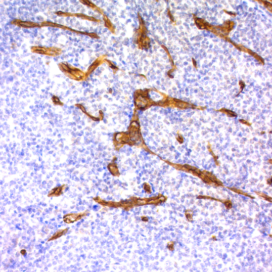 CD34, Endothelial Cell; Clone QBEnd/10 (Concentrate)